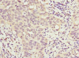 HOXD10 Antibody