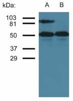 ICAM-1 / CD54 Antibody (clone MEM-111)