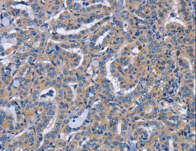 NCR2 / NKP44 Antibody