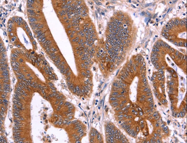 CRISP3 Antibody