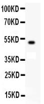 c-Kit / CD117 Antibody (aa26-285)