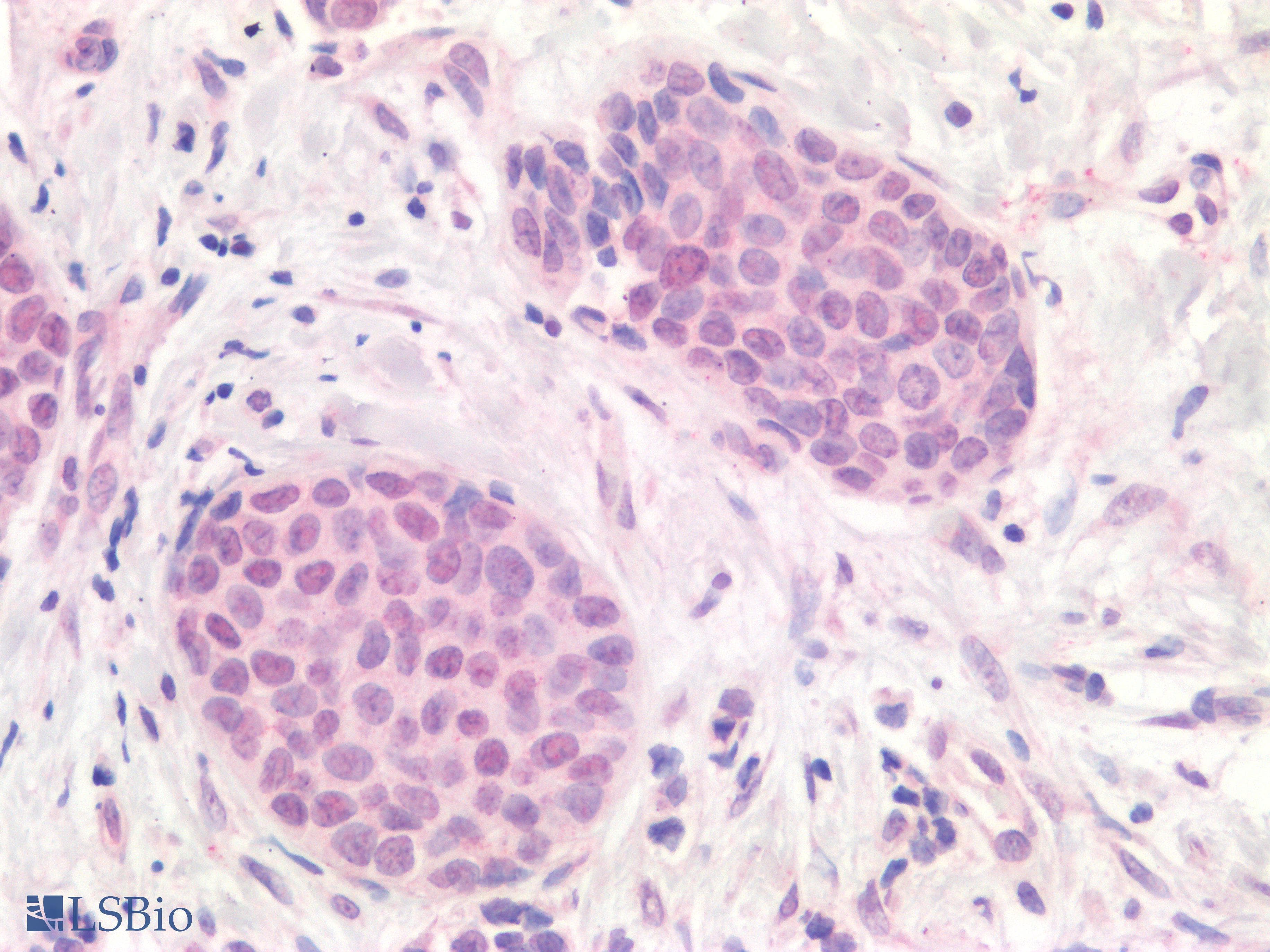 PathPlus™ APOBEC3B Antibody