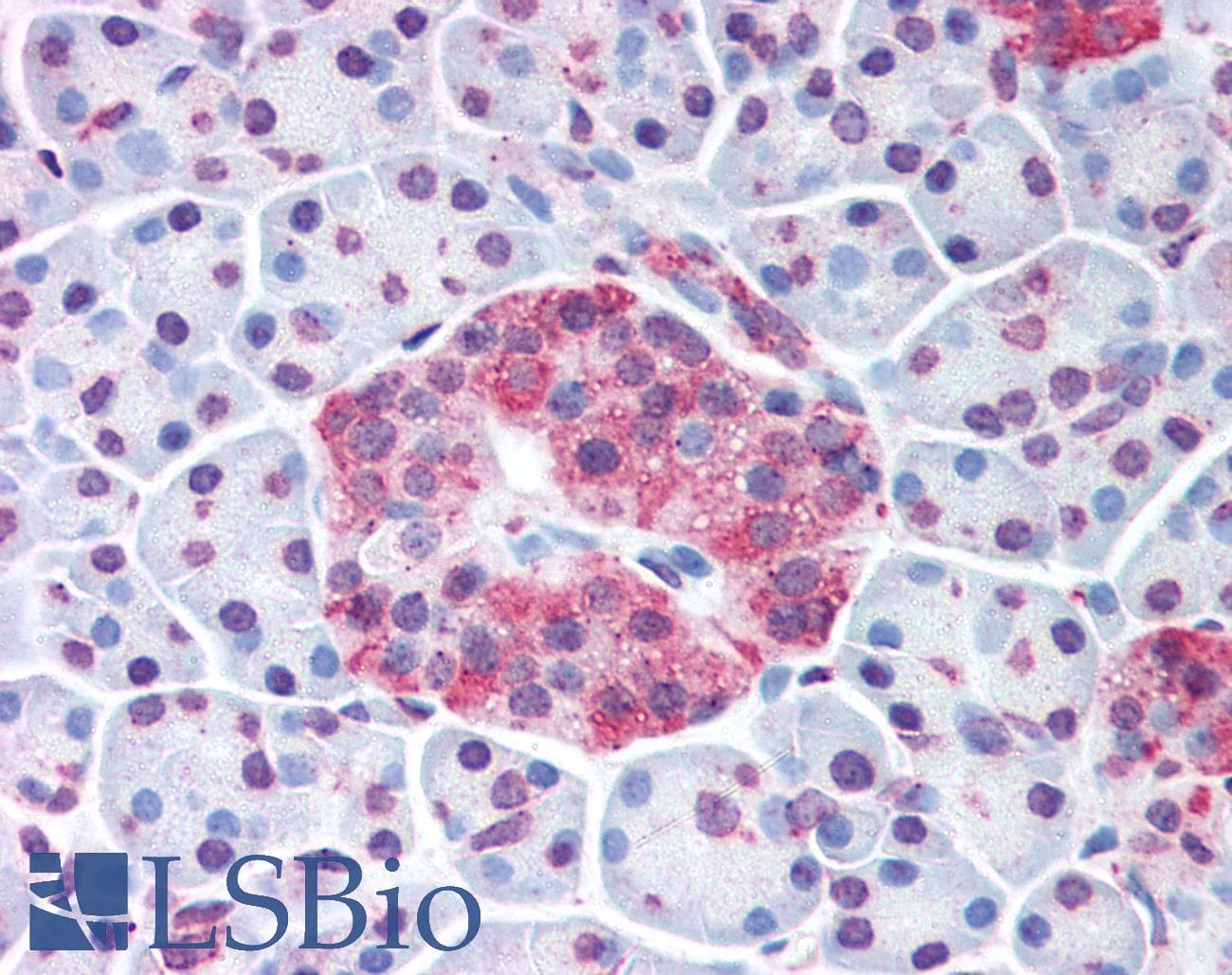 IHC-plus™ WNT10A Antibody (Internal)