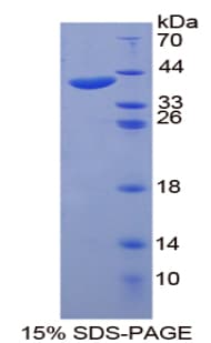 KRT20 / CK20 / Cytokeratin 20 Protein (Recombinant His-T7)