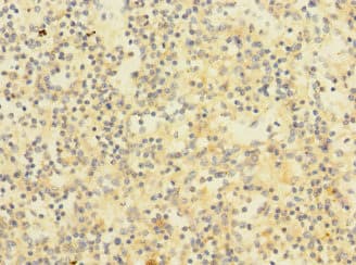 CHRNA2 Antibody