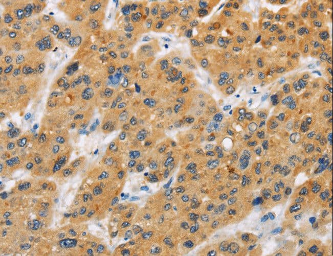 Polyclonal Rabbit anti-Human BTLA / CD272 Antibody (IHC)