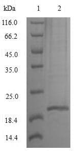 Rhesus monkey IL-10 Protein (Recombinant 10His, C-terminus)