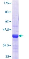 Human CD66c / CEACAM6 Protein (Recombinant GST, N-terminus)