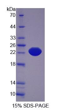 Human IL21 Receptor Protein (Recombinant His-S)