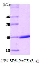 Human RARA / RAR Alpha Protein (Recombinant His)