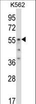Polyclonal Rabbit anti-Human ODC1 / Ornithine Decarboxylase Antibody (aa323-352, WB)