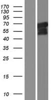 RASGRF1 / CDC25 Protein (Over-Expression Lysate Myc-DDK (Flag))