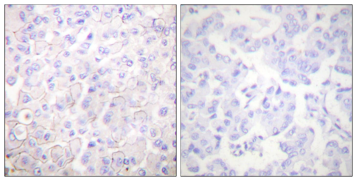 Cadherin Antibody (aa833-882)