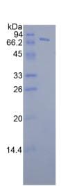 Human FKBP5 / FKBP51 Protein (Recombinant His-GST)