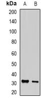 Polyclonal Rabbit anti-Human PSME3 Antibody (IF, WB)