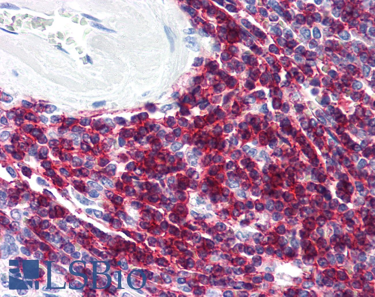 PathPlus™ CD6 Antibody (clone MEM-98)