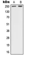 Neurofibromin / NF1 Antibody (Internal)