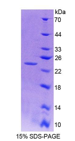 Mouse NIN / Ninein Protein (Recombinant His-T7)