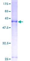 Human SLC25A36 Protein (Recombinant GST)
