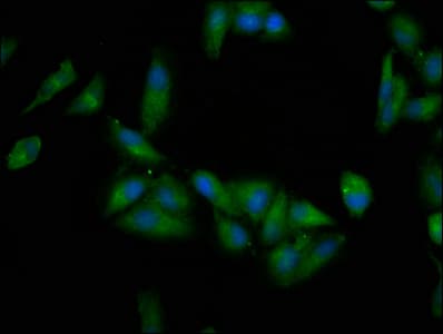 Polyclonal Rabbit anti-Human EPRS / PARS Antibody (IHC, IF, WB)