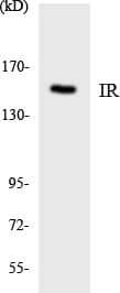 INSR / Insulin Receptor Antibody (aa1319-1368)