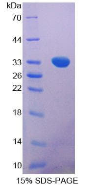 Mouse POMC / Proopiomelanocortin Protein (Recombinant His-T7)