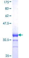 Human RXRG Protein (Recombinant GST, N-terminus)