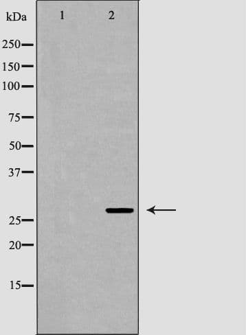 CLECSF6 / DCIR Antibody
