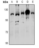 Arkadia / RNF111 Antibody