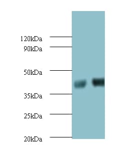 SHBG Antibody