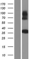 TSFM Protein (Over-Expression Lysate Myc-DDK (Flag))