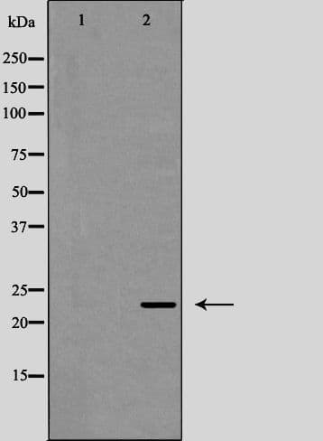 Polyclonal Rabbit anti-Human IL12A / p35 Antibody (IHC, WB)