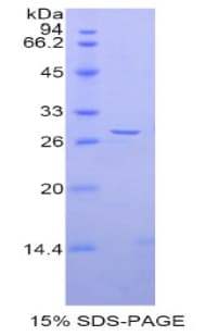 Rat Adam5 Protein (Recombinant His)
