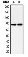 PRKCD / PKC-Delta Antibody (phospho-Tyr313)
