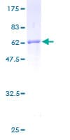 Human Fibulin-3 / EFEMP1 Protein (Recombinant GST)