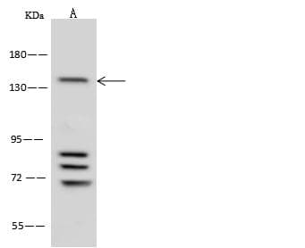 Polyclonal Rabbit anti-Human ATXN2 / SCA2 / Ataxin-2 Antibody (WB)