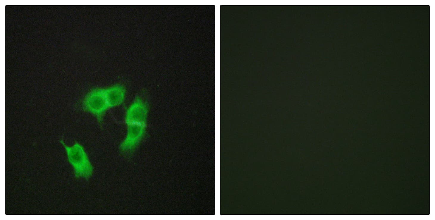 Polyclonal Rabbit anti-Human ARMCX3 Antibody (aa291-340, IHC, IF, WB)