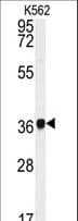 Polyclonal Rabbit anti-Human P40PHOX / NCF4 Antibody (aa260-289, IHC, WB)