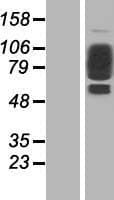 COL21A1 / Collagen XXI Protein (Over-Expression Lysate Myc-DDK (Flag))