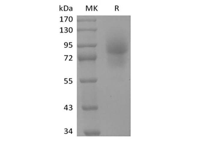 Human CD68 Protein (Recombinant Fc, C-terminus)