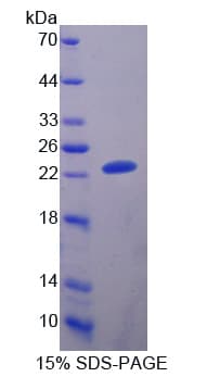 Bovine A1BG Protein (Recombinant His-T7)
