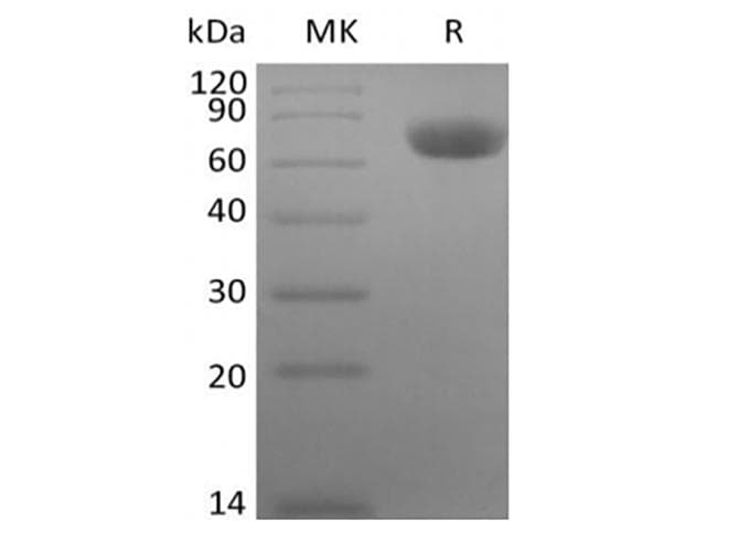 Rhesus monkey TNFRSF1B / TNFR2 Protein (Recombinant Fc, C-terminus)