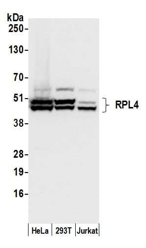 Polyclonal Rabbit anti-Human RPL4 / Ribosomal Protein L4 Antibody (aa377-427, WB)