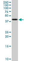 Monoclonal Mouse anti-Human SULT2B1 / Sulfotransferase 2B1 Antibody (clone 2E5, WB)