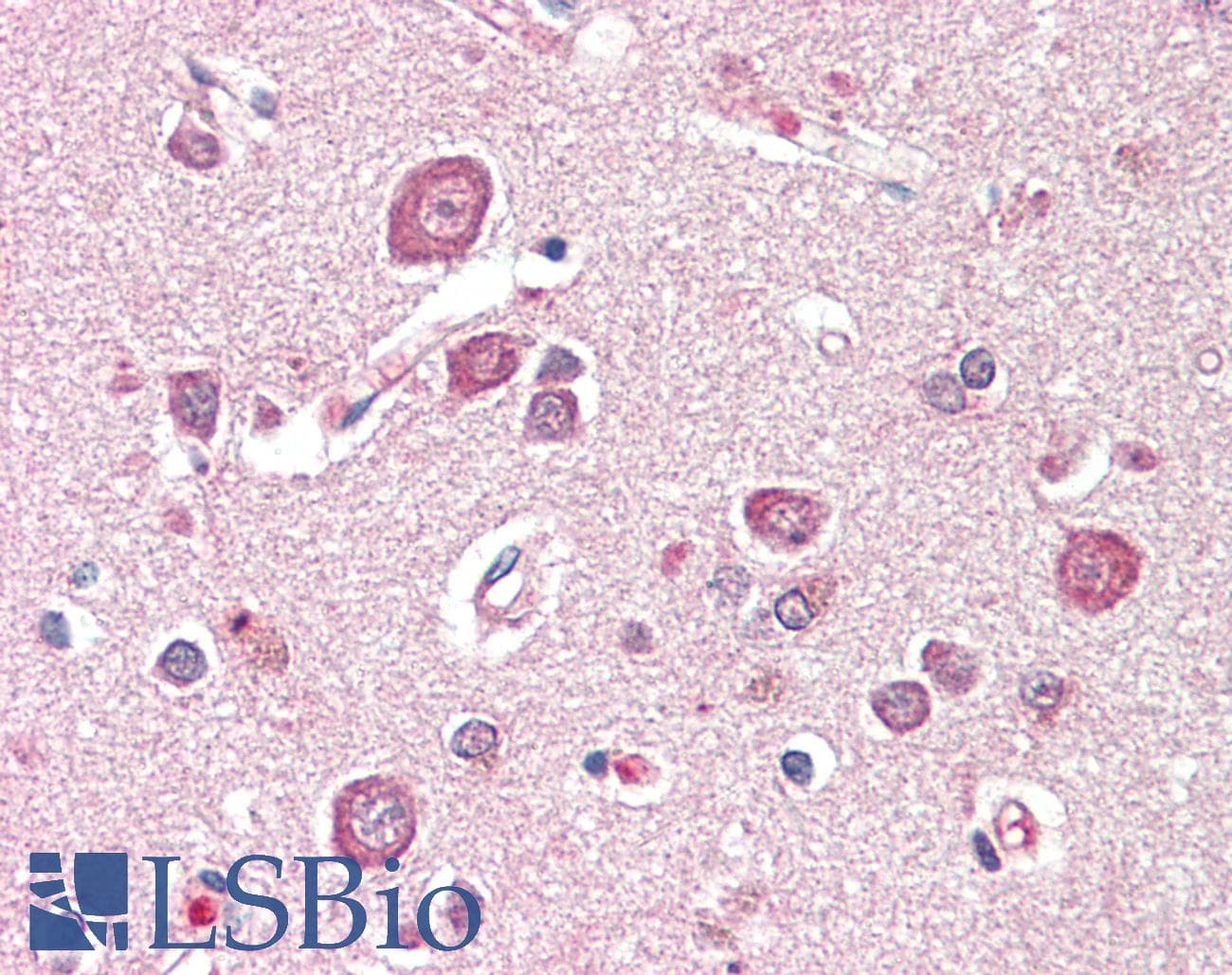 IHC-plus™ SDCCAG8 Antibody (aa121-135)