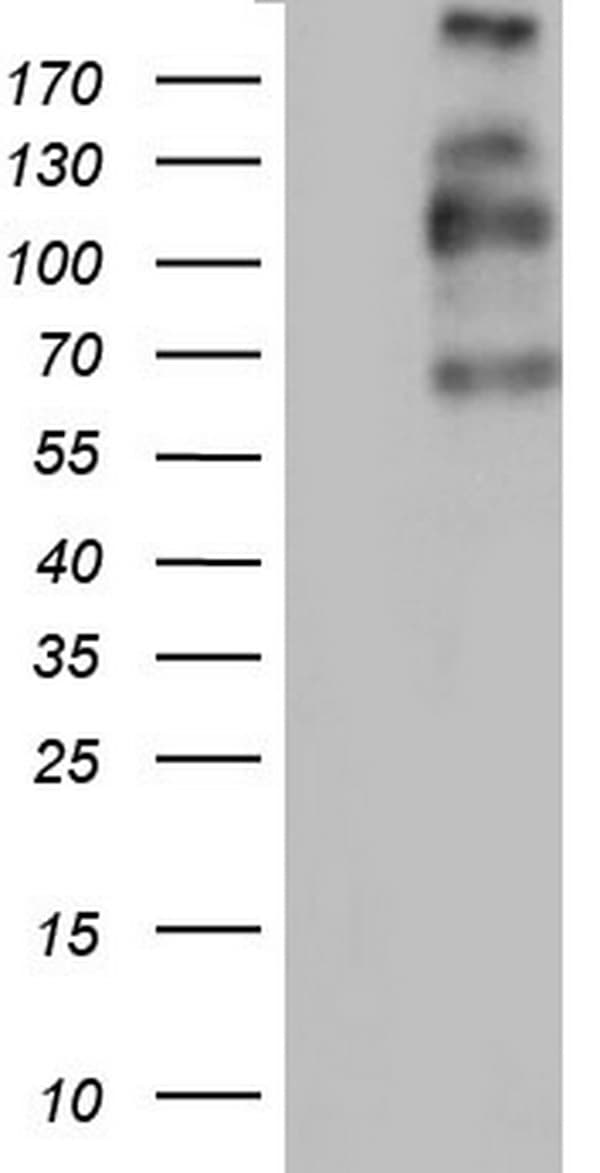 TG / Thyroglobulin Antibody (aa20-358, clone OTI8D4)