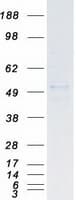 Human SKP2 Protein (Recombinant Myc-DDK (Flag))