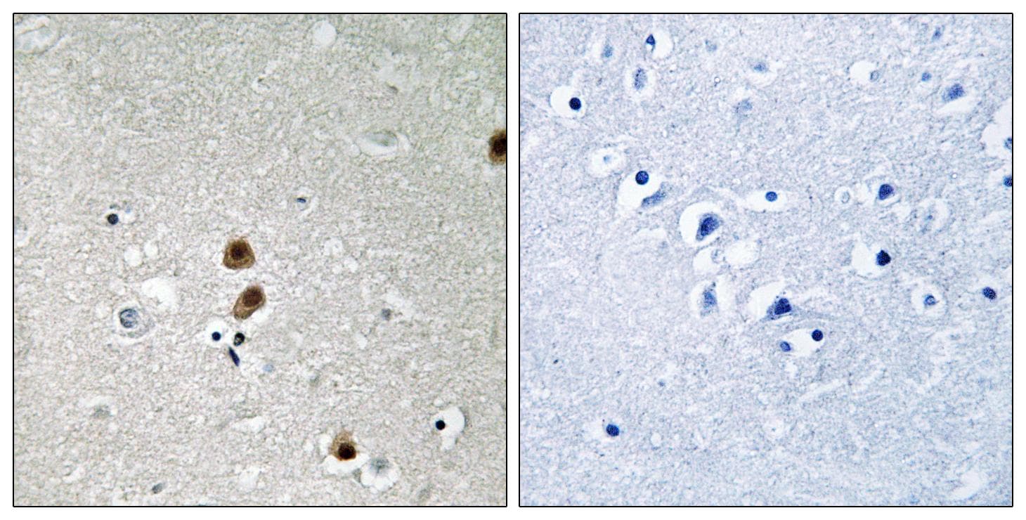 CTBP1 / CTBP Antibody (phospho-Ser422)