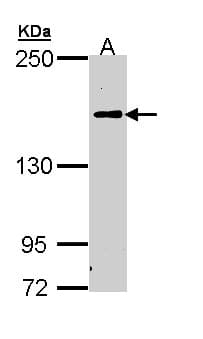 Polyclonal Rabbit anti-Human Complement C5 Antibody (aa1223-1451, IHC, WB)