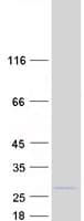 Human CIAPIN1 / Anamorsin Protein (Recombinant Myc-DDK (Flag))